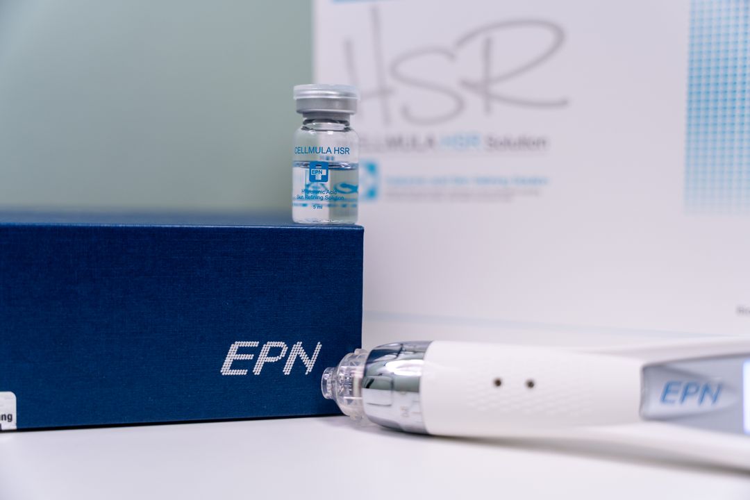 Micro-Needling with EPN Lynton - Ealing - Image 2