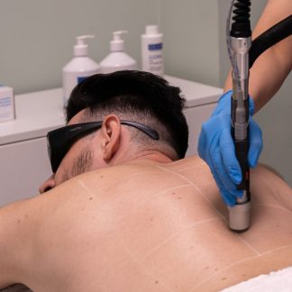 Men Laser Hair Removal - Ealing