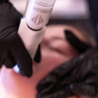 Resurfacing Facial with Crystal Clear Products - Ealing
